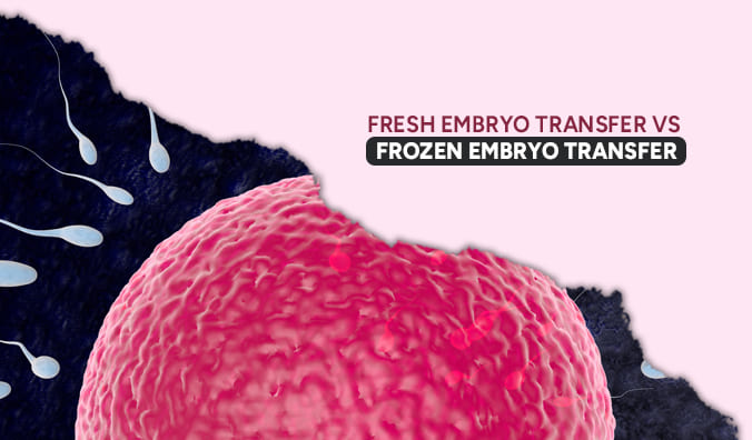 Fresh Embryo Transfer vs Frozen Embryo Transfer