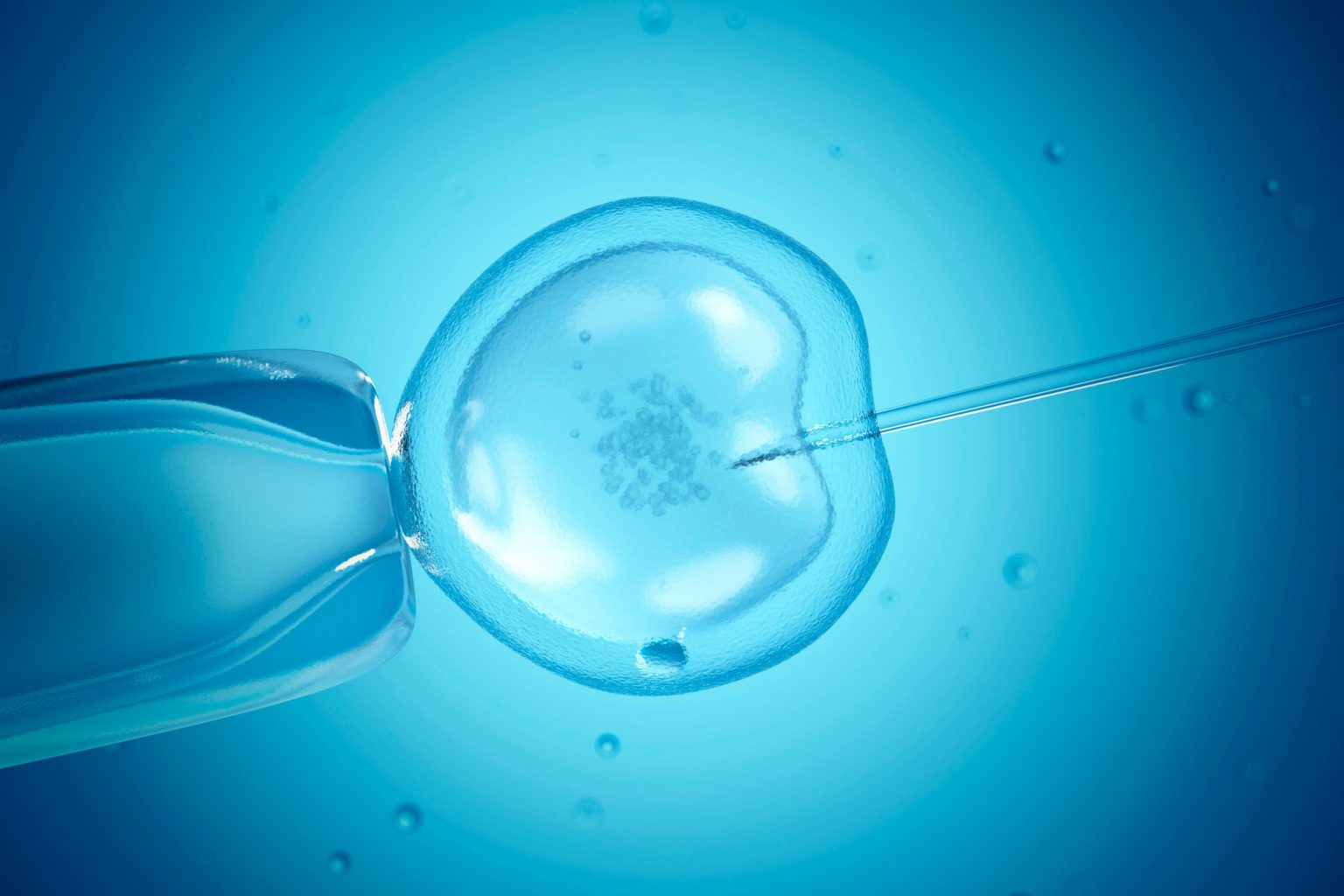 IVF treatment Chennai