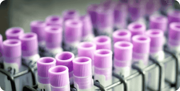 Fertility treatment at Aakash Fertility Centre Chennai — IVF specialists since 1991