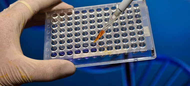 A scientific experiment in the laboratory. The study of biological sample in a well plate.